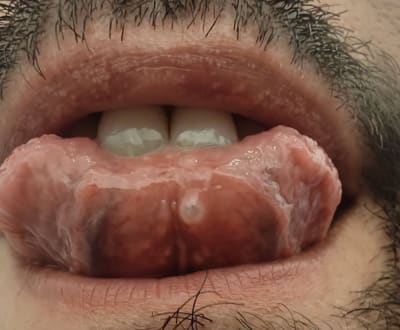 Folgq5j9tnh7iivtwp3jgcgn1nmc - Eugenol