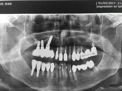 Fspn47klfjzc6nngmj8p - Eugenol