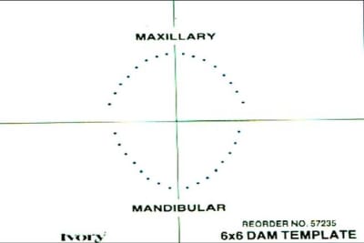 Gabarit digue mjl4jp - Eugenol