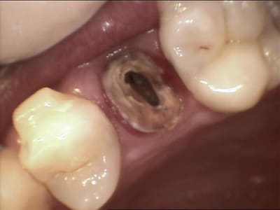 Gar3 hmfm1f - Eugenol