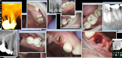 Gou zs9rof - Eugenol