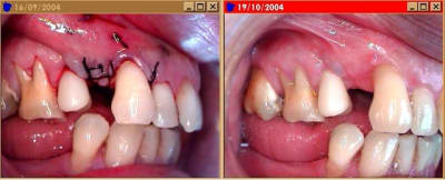 Greffe2 nxmdn5 - Eugenol