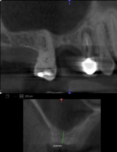 Gregoire1 btyibi - Eugenol