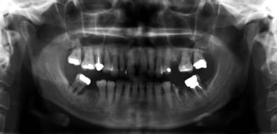 Guignols de metz mmxlck - Eugenol