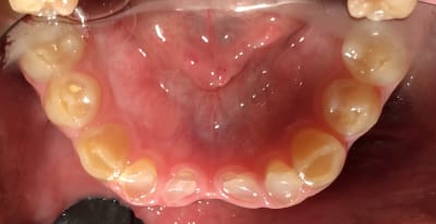 Gwc4syuy2hkqyl6hzmco - Eugenol