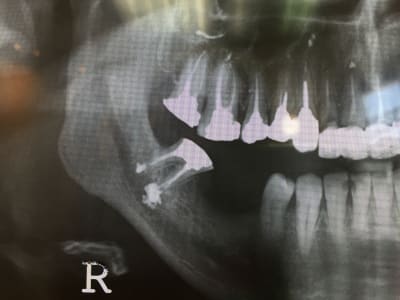 Hfsmbveizhozcmsclshk - Eugenol