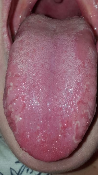 Hjfvw7nnfknn5x5voneo - Eugenol