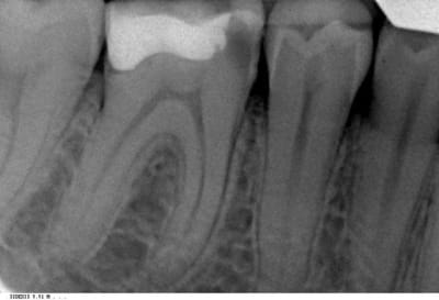 Hmg l10rnu - Eugenol