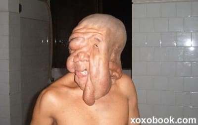 Huangchuncaisaftersurgery copy yqih2o - Eugenol