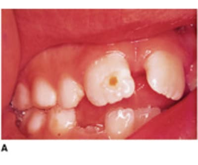 Hypotrau4 omsbeq - Eugenol