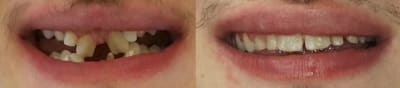 I2ix89tgtz7qpddnb5uzs57ooi6e - Eugenol