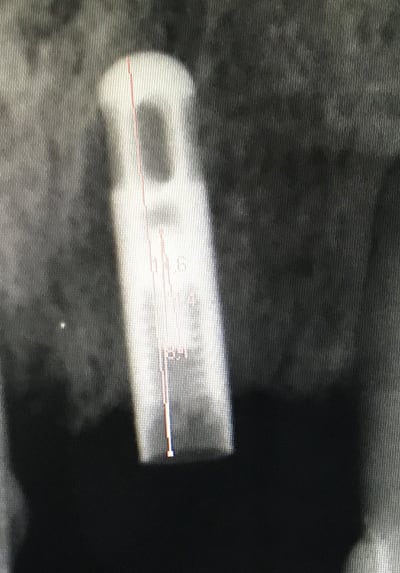 I8tw4sis61nv7bubnvzt - Eugenol