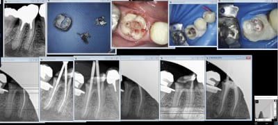 Ic clavette rte 1 2019 02 05 11.53 - Eugenol