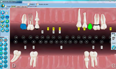 Icone radio txooe4 - Eugenol