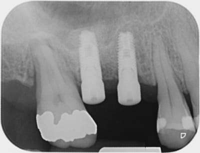 Ident2 iwwzem - Eugenol