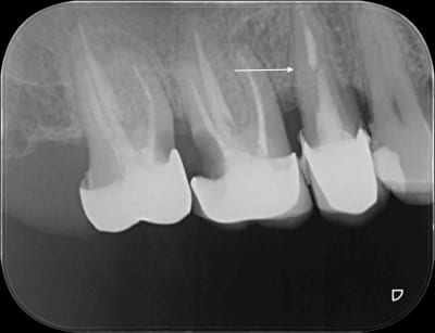 Ie00pfvxhml1swjx0rfy kru051 - Eugenol