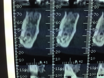 Image urdy8a - Eugenol