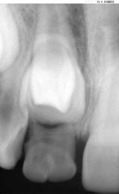 Images sop ftak6n - Eugenol