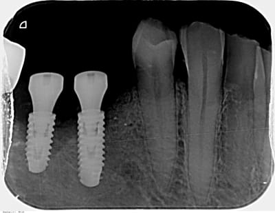 Imf6iprk8oi020lmf91r - Eugenol
