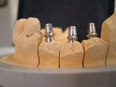 Implants 002 tektnq - Eugenol