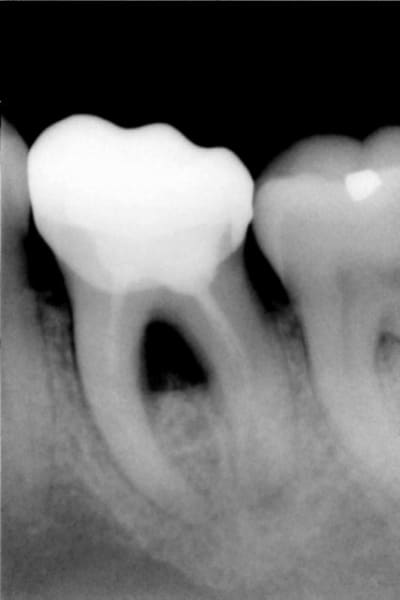 Initial uspgof - Eugenol