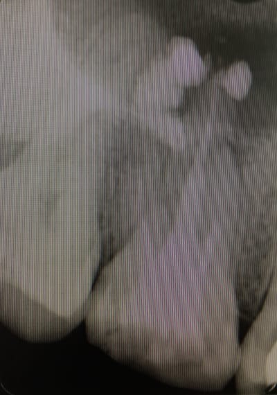 Iras6oiwu7jgfjehfqr6 - Eugenol