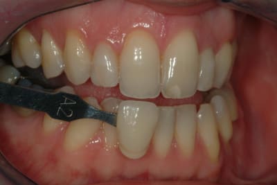 Jackets 12 22 ayle8k - Eugenol