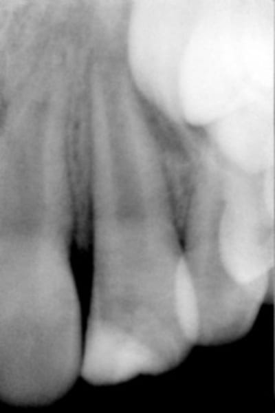 James mifzjr - Eugenol