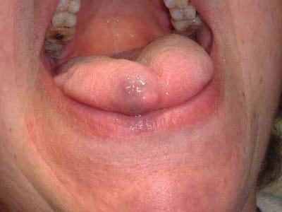 Jau2 xvc9zy - Eugenol