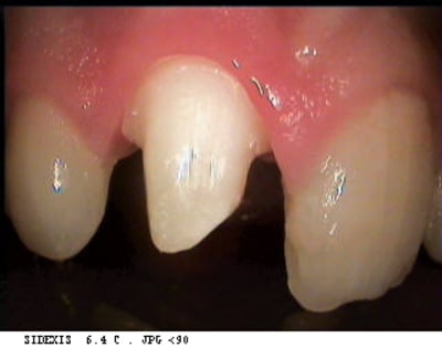 Jeris3 kimr34 - Eugenol