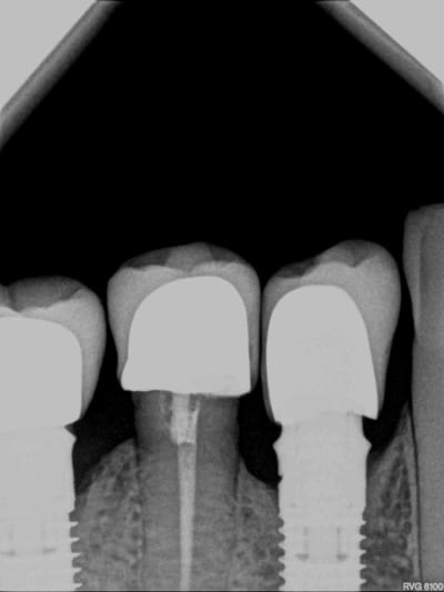 Jhqtaxss35tkzkbnnubu - Eugenol