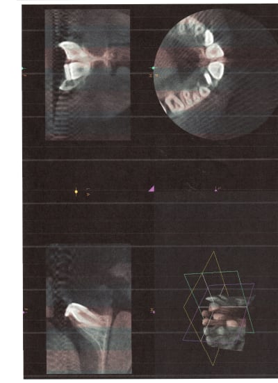 Jitulr3ewbvpkaenouuv - Eugenol