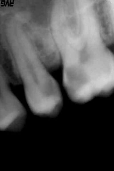 Jo5 pqvygl - Eugenol