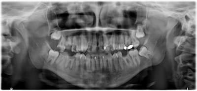 Jurdaob29wuckrgrqy4s - Eugenol