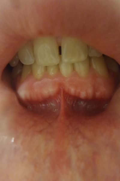 Jw5rioi5j5vpbbknd6gv - Eugenol