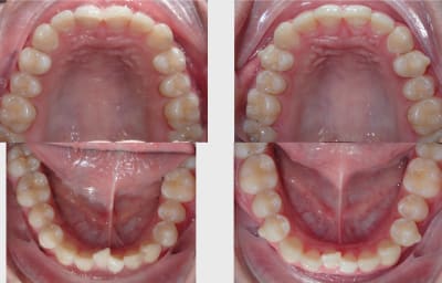 K4p8hejbl730cgznduj4ecbumnxg - Eugenol