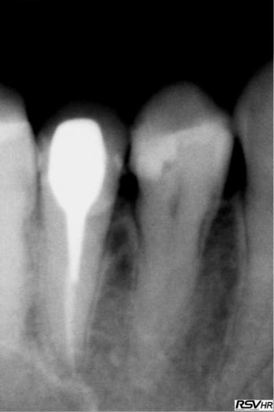Ked4 rcry9d - Eugenol
