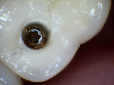 Kqh5ob9gmv9cryn2fmdh - Eugenol