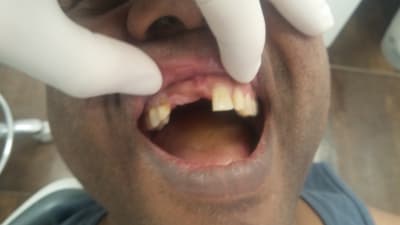 Kzmqyc9zk3vn4woogy16 - Eugenol