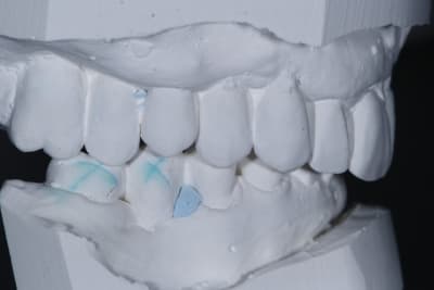 L  6 novembre 2014 gcsqeq - Eugenol