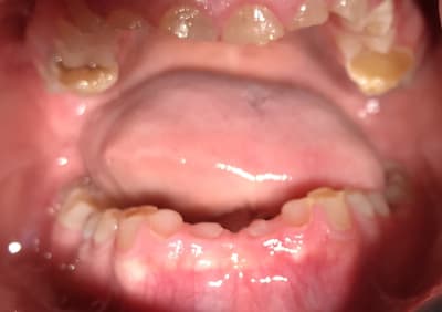 L14hzddlfain3mll2lsk - Eugenol