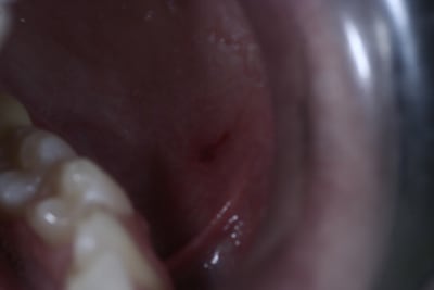 L sion 001 kutcu5 - Eugenol