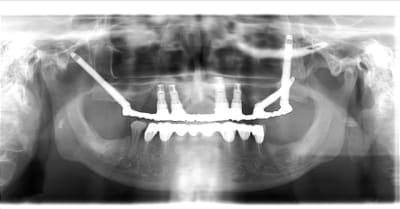 La classe vuoutl - Eugenol