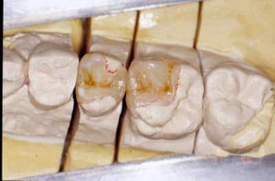Labo mholtu - Eugenol