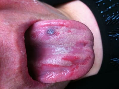 Langue gchoao - Eugenol