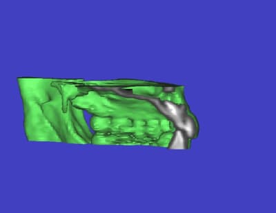 Le 3d myvcjt - Eugenol