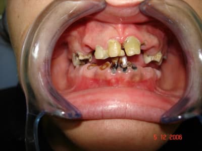 Le bescond 2 mzcm4o - Eugenol