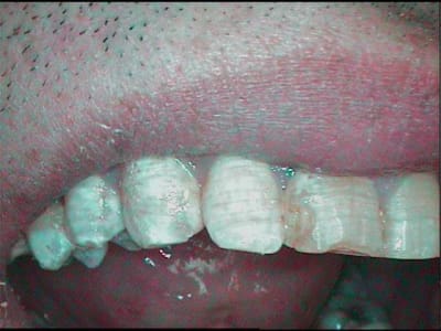 Le papa uomqqa - Eugenol