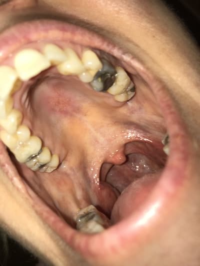 Lgaw3jua9w5gso0qzpxq - Eugenol