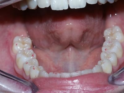 Mand1 do4hji - Eugenol